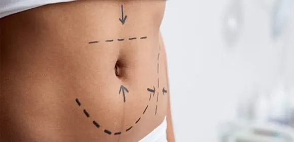 فن العمليات التجميلية في اسطنبول