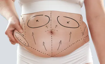 Small Incisions